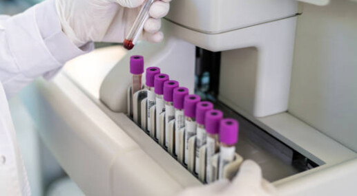 Dlaczego test FIT daje różne wyniki? Kontrowersje w diagnostyce raka