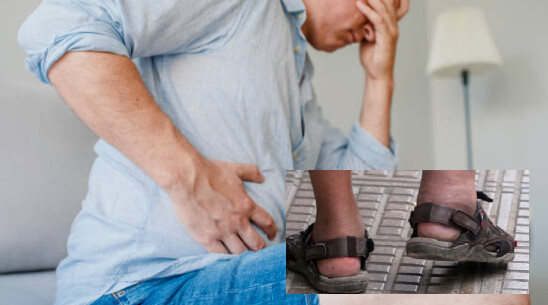 Zmiany na nogach mogą sygnalizować problemy z wątrobą