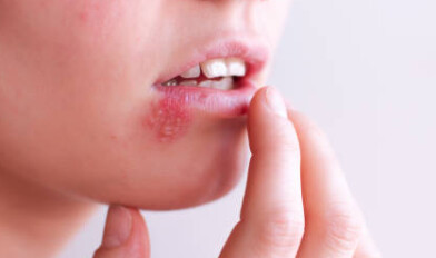 Czego brak w organizmie, gdy pojawia się opryszczka?