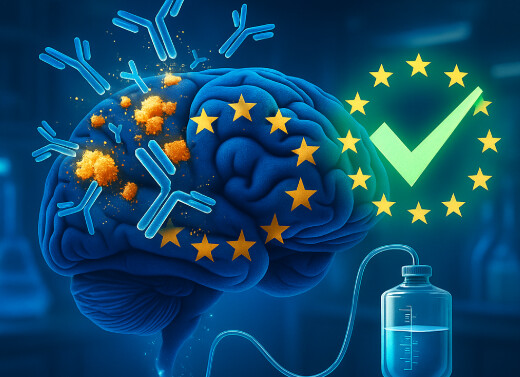 Leki modyfikujące przebieg Alzheimera – zielone światło dla lecanemabu