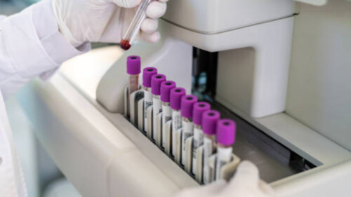 Dlaczego test FIT daje różne wyniki? Kontrowersje w diagnostyce raka