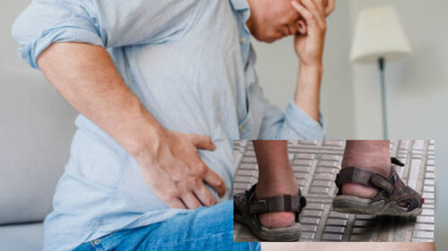 Zmiany na nogach mogą sygnalizować problemy z wątrobą